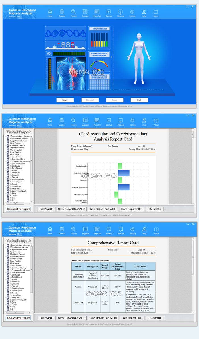 The New Hand Touch quantum resonance megnetic analyzer