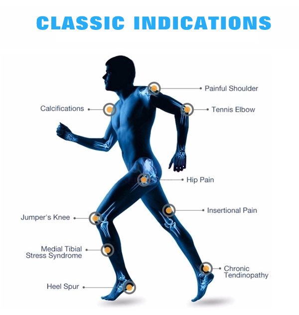 The latest shock wave therapy machine Hot sell!!